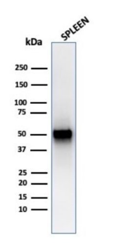 PD-ECGF/Thymidine Phosphorylase Antibody (rTYMP/3444) - Azide and BSA Free,